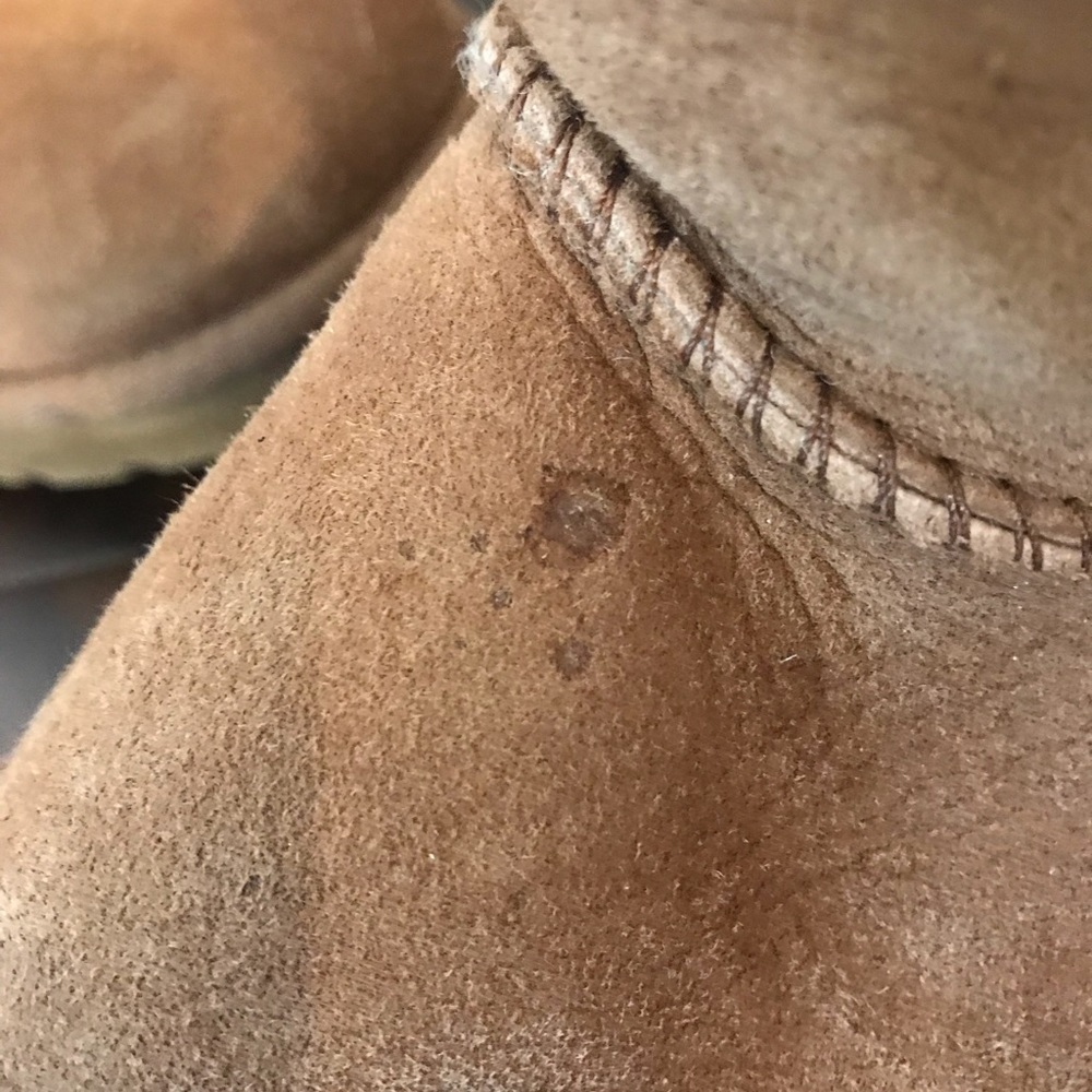 Ugg Bailey Button Boot - image 7